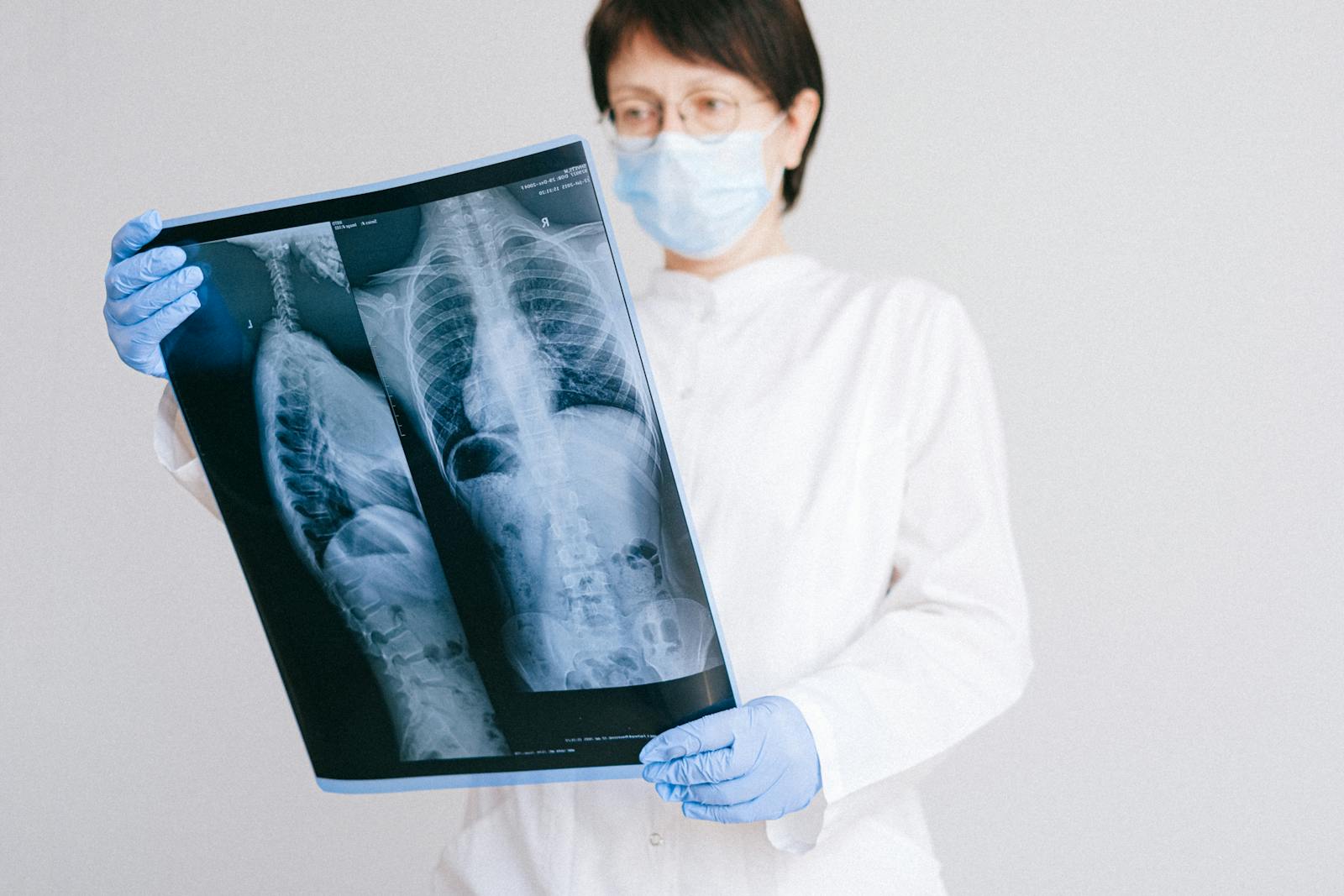 Radiologist reviewing an X-ray image